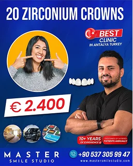 E-MAX CROWNS